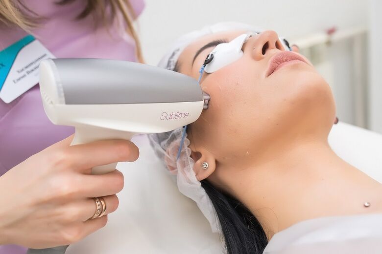 Performing a procedure for laser skin rejuvenation