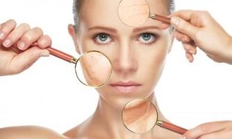 Does Laser Fractional Rejuvenation Solve Skin Problems 